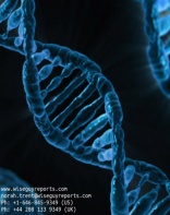 Hospital Cleaning Trolleys Industry Global Market Research Report 2016